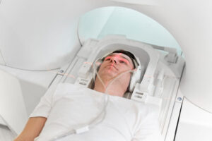 Understanding Radiation Therapy Side Effects and Guidance from Experts