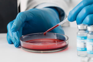 Side Effects During Blood Cancer Treatment: And How to Manage Them